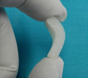 Collagen scaffolds (CS).