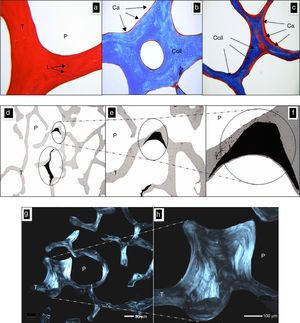Morphological characterization with optical microscopy. (a) CS stained with H&E, pores (P) and trabecules (T) with multiples lacunae (L) can be seen. (b) CS stained with Masson