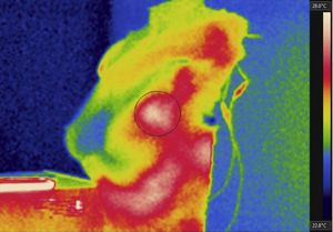 Thermal image from an infiltrating ductal carcinoma simulated area.