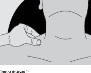 Presión del trapecio. Tomada de Jevon P51.