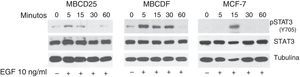 EGF induce fosforilación de STAT3 en las células de cáncer de mama MBCDF, MBCD25 y MCF-7. Las células de cáncer de mama MBCD25, MBCDF, y MCF-7 se trataron con EGF 10ng/ml a los tiempos 0, 5, 15, 30 y 60min. Se realizó western blot para analizar la fosforilación de pSTAT3 (Y705) usando anticuerpos fosfoespecíficos (panel superior). La cantidad total de STAT3 se analizó usando un anticuerpo anti-STAT3 (panel medio). Se utilizó un anticuerpo anti α-tubulina como control de carga de la proteína total (panel inferior).