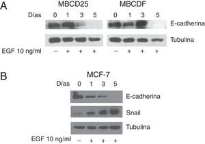 EGF induce la pérdida de expresión de E-cadherina y aumento de la expresión de Snail en células MBCDF, MBCD25 y MCF-7. A. Las células de cáncer de mama MBCD25 y MBCDF se trataron con EGF 10ng/ml a los días 0 y 3. Se realizó western blot para analizar la expresión de E-cadherina (panel superior). Un anticuerpo anti α-tubulina fue utilizado como control de carga de la proteína total (panel inferior). B. La línea celular MCF-7 se trató con EGF 10ng/ml los días 0 y 3. Se realizó western blot para analizar la expresión de E-cadherina (panel superior) así como para analizar la expresión de Snail (panel medio). El anticuerpo anti-α-tubulina fue utilizado como control de carga de la proteína total (panel inferior).