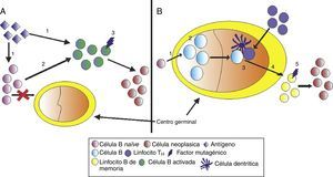 A) LLC con regiones IGHV no mutadas: 1) Estimulación mediante antígeno (Ag) independiente de células T; 2) activación del linfocito B, y 3) evento neoplásico. B) LLC con regiones IGHV mutadas: 1) activación de la célula B naïve dependiente de linfocito T; 2) expansión clonal e hipermutación somática; 3) estimulación del linfocito B por el linfocito T cooperador (TH); 4) el linfocito B se activa y pasa a linfocito B de memoria, 5) evento neoplásico.
