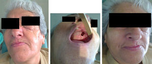 Imágenes clínicas: facial e intraoral.