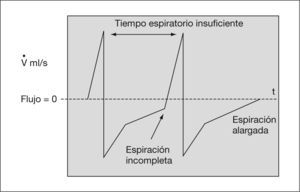 Trazado de flujo.