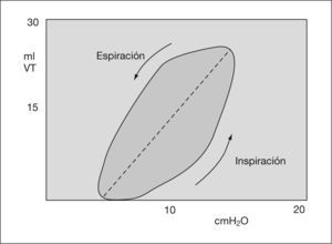Gráfico de presión-volumen. Distensibilidad. VT: volumen tidal.