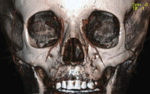 Figura 2
