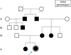 Árbol genealógico con presencia de MC en los diferentes miembros de la familia y señalando mediante flecha la paciente caso, objeto de nuestro estudio.