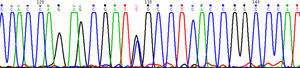 La amplificación y posterior secuenciación del exón 7 del gen FGFR2 detectó la presencia en heterocigosis de la mutación S252W (c.755C>G). Esta mutación, junto con la del codón adyacente P253R (c.758C>G), son las responsables de la aparición del síndrome de Apert. Mutaciones germinales en el gen FGFR2 producen alteraciones esqueléticas congénitas debido a una activación anómala de las rutas de transducción de señales en las que participa.