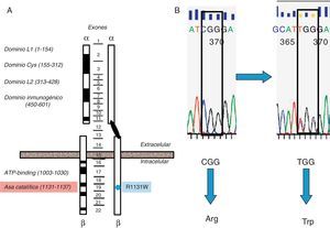 Representación esquemática del gen del receptor de insulina y mutación de la paciente. A) Representación esquemática del gen del receptor de insulina y localización de la mutación detectada en nuestra paciente (punto azul) afectando al dominio catalítico del receptor (Arg-Asp-Leu-Xaa1-Xaa2-Xaa3-Asn, residuos aminoácidos 1131-1137, localizados aproximadamente unos 100 residuos aguas abajo del sitio de unión a ATP) (sombreado en rojo). Los exones quedan indicados en el centro de la figura. B. Mutación Arg1131Trp de la paciente. B) Esferograma con la secuencia normal del gen del receptor de insulina (CGG→arginina) y la mutación en la paciente (TGG→triptófano).