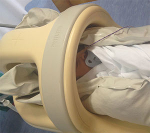 RN dentro de la antena neonatal de RM, envuelto en sábanas e inmovilizado por el colchón de vacío.
