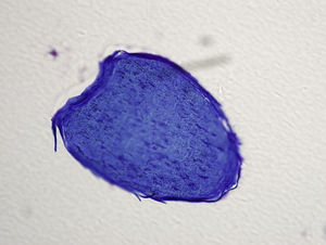 Imagen de microscopio óptico, corte semifino.