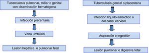 Vías de transmisión de tuberculosis congénita.