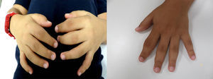 Imágenes fotográficas de las manos del paciente.
