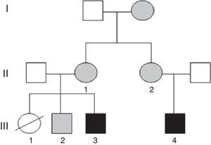 Árbol genealógico en el que se incluyen los individuos que se presentan. En negro: individuos con traslocación no equilibrada y discapacidad intelectual. En gris: individuos portadores de traslocación equilibrada (III.3=caso 2; III.4=caso 1).