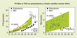 Las concentraciones séricas de T4 libre (FT4) de los prematuros de 27 a 36 semanas de gestación en los diferentes momentos después del nacimiento no solo son más bajas que las de los recién nacidos a término de igual edad posmenstrual, sino que son claramente inferiores a las concentraciones que hubiesen tenido de seguir desarrollándose in utero. La TSH sérica de los prematuros es igual que la de los recién nacidos a término, pero notablemente inferior a la que hubiesen tenido in utero. Fuente: datos de Ares et al.27 superpuestos a los datos obtenidos por cordocentesis por Thorpe-Beeston et al.4.