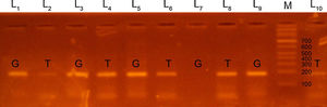 Productos de la amplificación del locus rs5370 del gen EDN1 mediante reacción en cadena de la polimerasa (PCR-ARMS) con identificación de los genotipos GT (calles 3-6, 9, 10) y GG (calles 1, 2, 7, 8); la calle M corresponde al marcador de peso molecular. L: calle.