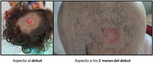 Figura 2