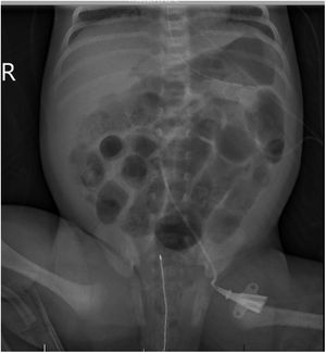 Radiografía abdominal.