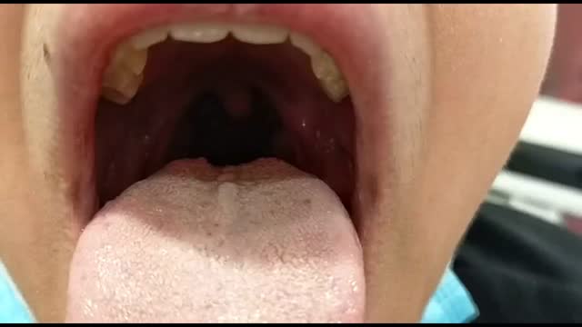 https://ars.els-cdn.com/content/image/1-s2.0-S1695403323000413-mmc1.mp4