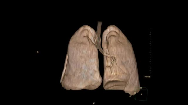https://ars.els-cdn.com/content/image/1-s2.0-S1695403323001510-mmc1.mp4