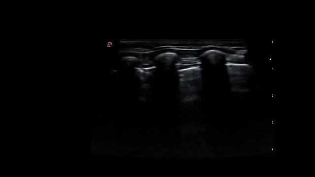https://ars.els-cdn.com/content/image/1-s2.0-S1695403324000328-mmc1.mp4