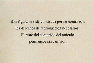 Colocación del paciente en la mesa de litotricia en decúbito supino y bajo sedoanalgesia con hidrocloruro de petidina y midazolam. El generador de ondas de choque se apoya en el dorso del paciente sobre la zona a tratar y en la parte anterior el fluoroscopio permite centrar la litiasis y visualizar su fragmentación en el monitor. Fuente: Elaboración propia del autor de correspondencia.