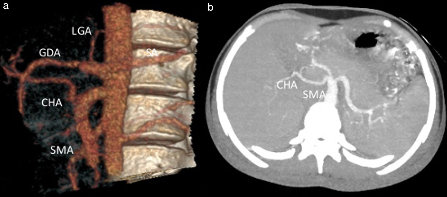 fig0010