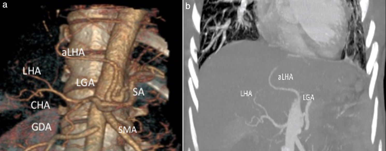fig0015