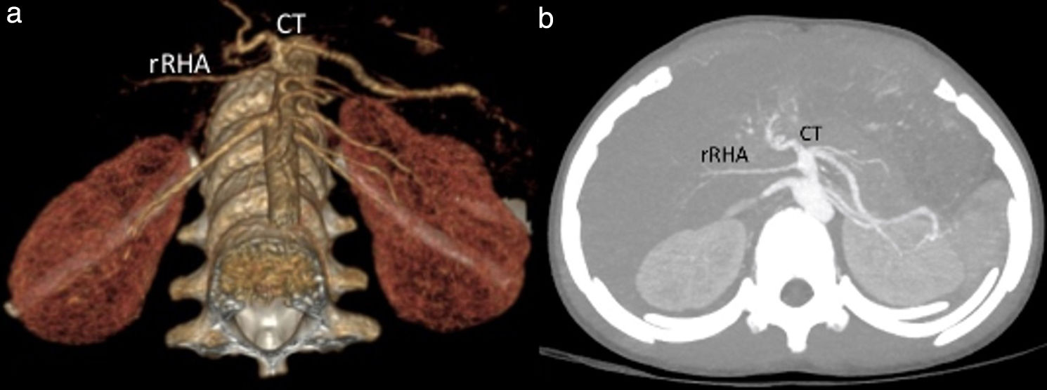fig0020