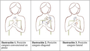 Tipos de posiciones canguro. Fuente: Elaboración propia (Lucía Jiménez).