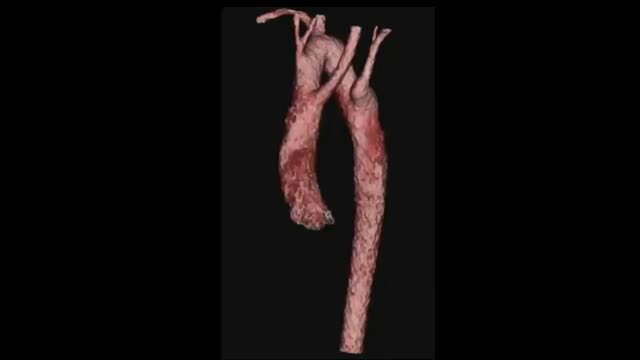 https://ars.els-cdn.com/content/image/1-s2.0-S1695403324002170-mmc2.mp4
