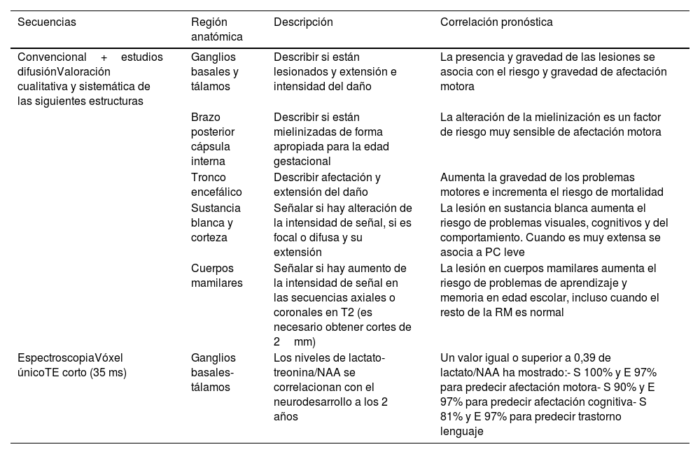 Tablas