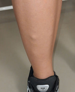 Musculatura en reposo.