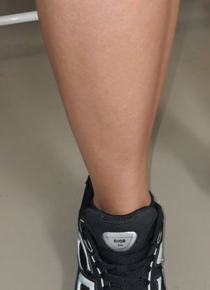 Musculatura contraída.