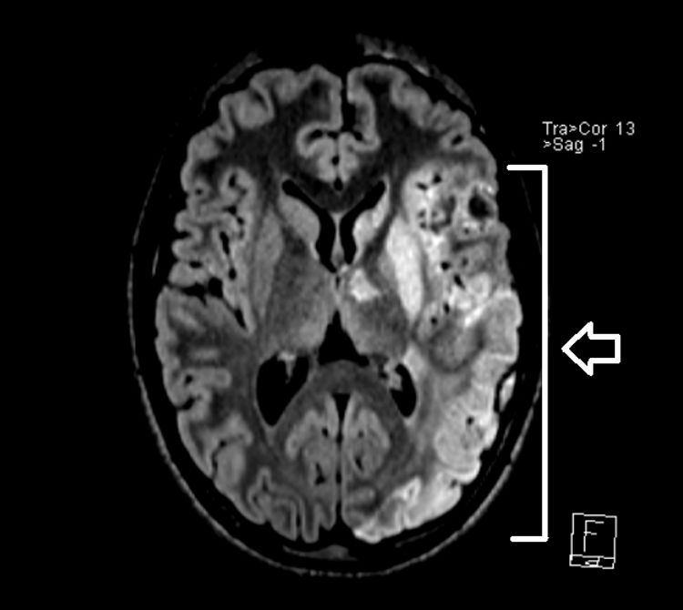 fig0010