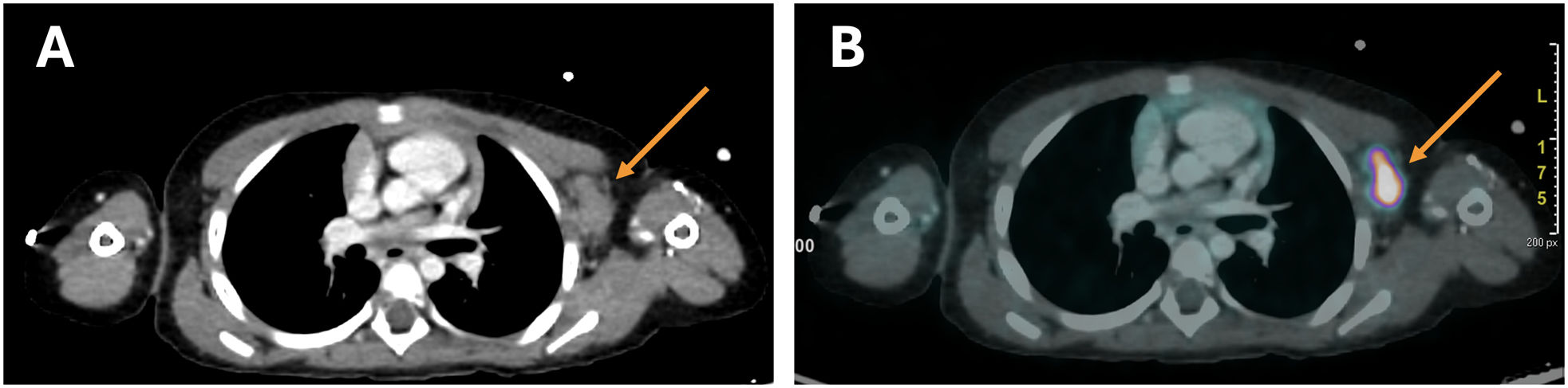 fig0015