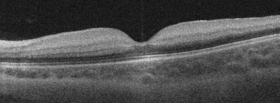 fig0010