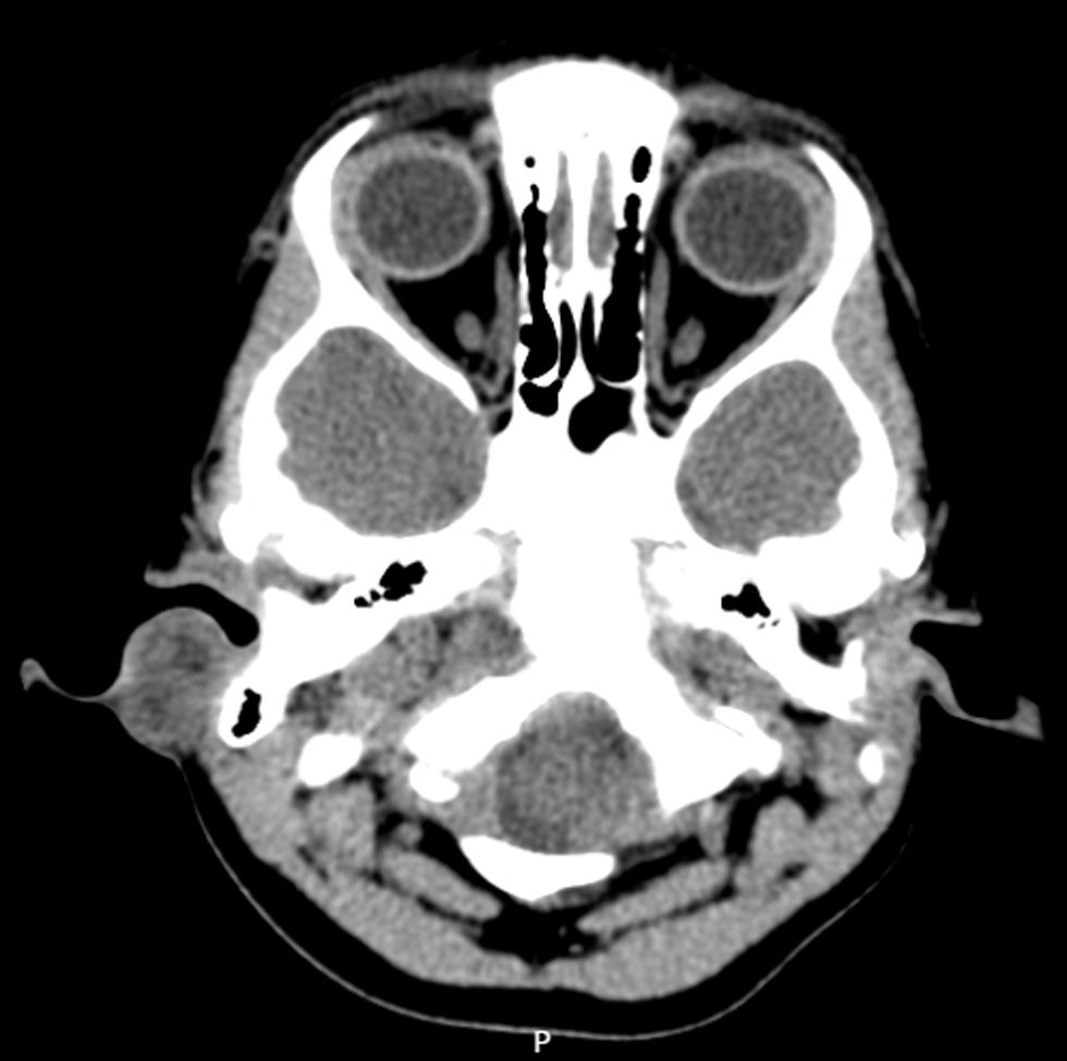 fig0010