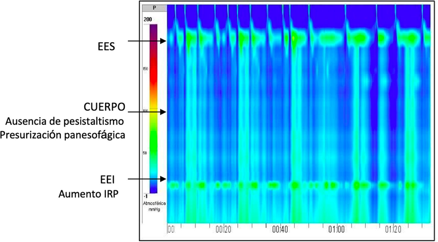 fig0015