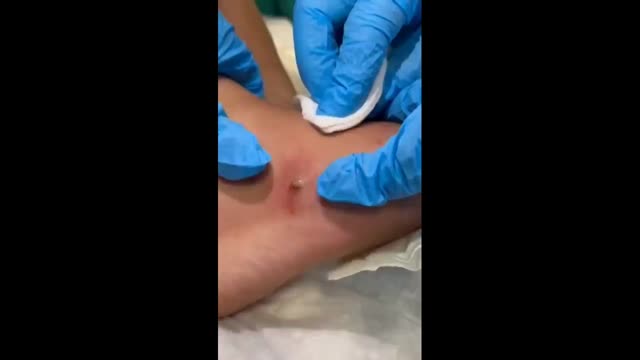 https://ars.els-cdn.com/content/image/1-s2.0-S1695403326000342-mmc1.mp4