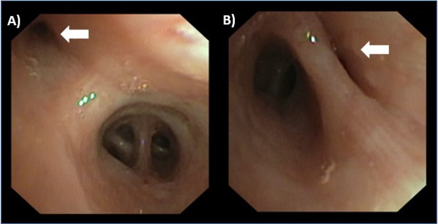 fig0015