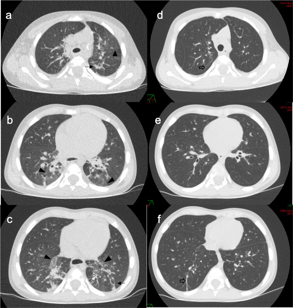 fig0010