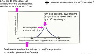 Curva de timpanograma (elaboración personal).