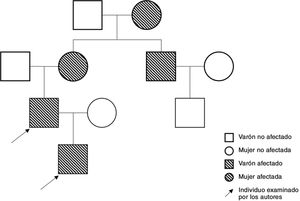 Pedigrí de la dentinogénesis imperfecta en base a los antecedentes médicos familiares, abarcando cuatro generaciones.