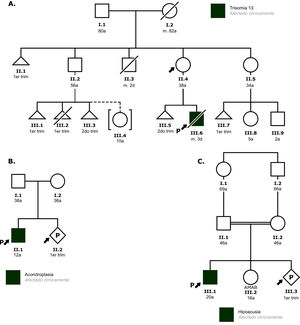 Ejemplos de árboles genealógicos (pedigrís). Los símbolos del pedigrí se refieren al género: los cuadrados representan varones; los círculos, mujeres; los triángulos, abortos espontáneos; los triángulos cruzados, interrupción legal/voluntaria del embarazo; los rombos, personas con género desconocido o no binario; los símbolos cruzados indican que la persona ha fallecido, y la letra «P» indica gestación en curso. La flecha señala la persona consultante o la persona por la que se consulta, y la flecha junto a una letra «P» indica al probando. Los números romanos hacen referencia a la generación, y los números arábigos, al individuo. AMAB: asignado hombre al nacer (assigned male at birth). A) Familia con antecedentes de abortos en varios de los miembros. La consultante desea conocer su riesgo de tener un nuevo descendiente enfermo. A la vista del pedigrí, se plantea que lo más probable es que sea portadora de una translocación equilibrada, pudiendo una nueva gestación conllevar a un nuevo aborto, a un descendiente con enfermedades congénitas debido a heredar la translocación desequilibrada, a un descendiente sano portador de la misma translación equilibrada o a un descendiente con una dotación cromosómica sin alteración. Se le ofrecerá la posibilidad de realizar un cariotipo. B) Ante un antecedente familiar de acondroplasia, se consulta sobre el riesgo de recurrencia en un embarazo en curso. Dada la herencia autosómica dominante de dicha enfermedad, y que ninguno de los progenitores la manifiesta, se exponen a la pareja la posibilidad de mosaicismo gonadal, y los riesgos y beneficios de una amniocentesis para la detección de la variante familiar. C) A la vista del árbol familiar, se infiere que los más probable es que ambos progenitores sean portadores de la variante causal de la hipoacusia. Por tanto, el riesgo a priori del nuevo descendiente de presentar la enfermedad es del 25%. Se ofrece la posibilidad de estudio genético dirigido a ambos progenitores.