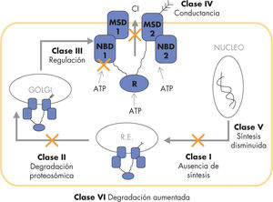 Clasificación de las mutaciones del genCFTR. Los defectos del gen CFTR incluyen la ausencia de síntesis (clase I), los defectos por alteraciones de maduración y degradación proteosómica (clase II), las alteraciones de la regulación (clase III) y de la conductancia del canal (clase IV) y la reducción del número de transportadores debido a una menor síntesis (clase V) o a una mayor degradación (clase VI). ATP: adenosintrifosfato; Cl: cloro; MSD: dominio de fijación de la membrana (membrane spanning domain); NBD: dominio fijador de nucleótidos (nucleotide binding domain); R: dominio regulador.