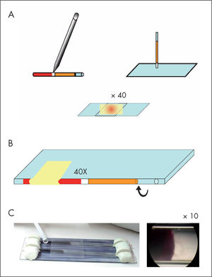 Variantes de las formas de visualización de la técnica del tubo capilar o microhematocrito. Adaptado de Freilij et al11 (A), Torrico et al10 (B) y Schneider et al, comunicación personal (C).
