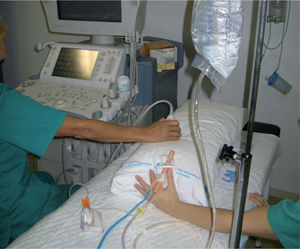 Desinvaginación con suero guiada por ultrasonido. Simulación en sala de ecografía que muestra sistema de enema con sonda de balón hinchable.