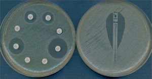 A) Antibiograma por difusión con discos en el que se observa la presencia de halos de inhibición. B) Antibiograma por E-test en el que se observa una elipse de inhibición. El punto donde la elipse corta con la tira es el valor de CMI, en este caso 0,5 mg/l.